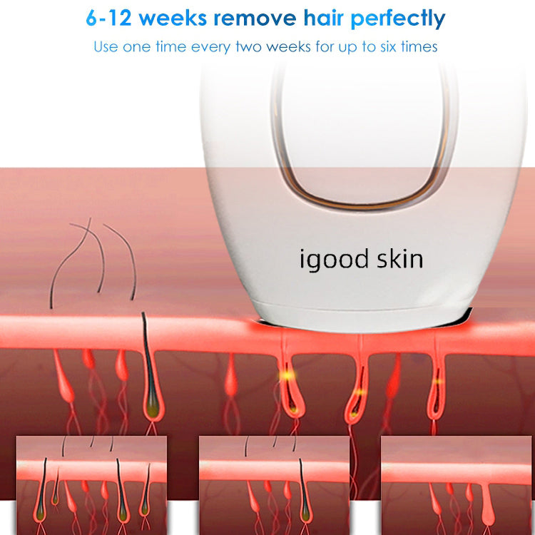 IGOODSKIN@IPL Hair Removal Handset